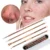 Blackhead Remover